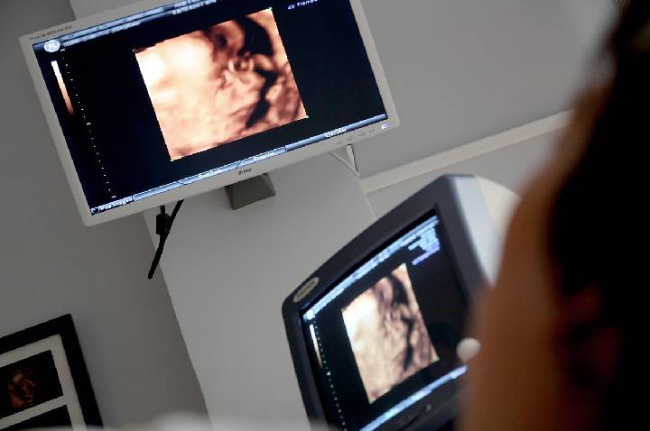 Pesquisa reforça técnica fetal para hérnia diafragmática