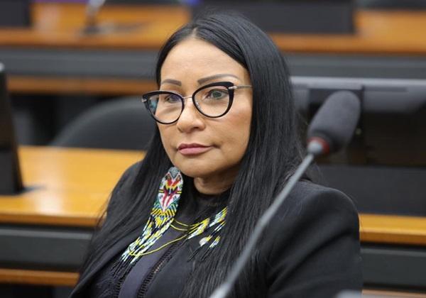 Justiça cassa mandato de deputada acusada de pagar harmonização com dinheiro da campanha