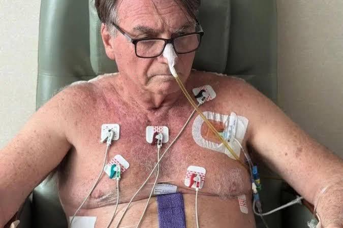 A SAÚDE DE BOLSONARO E OS PRESIDENCIÁVEIS